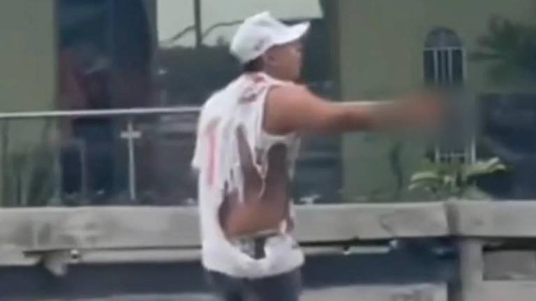 Joven perdió una mano tras explosión de petardo en el sur de Guayaquil