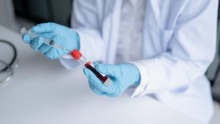 ¿Qué es el virus Shamonda? Francia reporta primer caso de la enfermedad en humanos