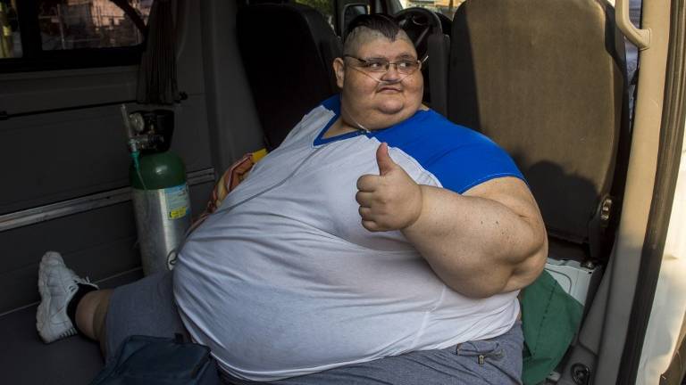 El hombre más obeso del mundo sale "bien" de operación