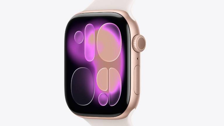 Las diferencias entre el nuevo Apple Watch Series 11 con la versión anterior: conoce detalles