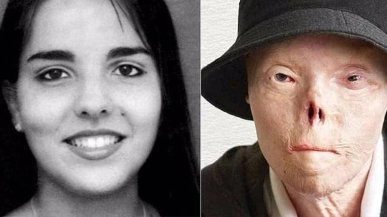 La trágica historia de la mujer que se convirtió en el rostro de campañas de conducción segura