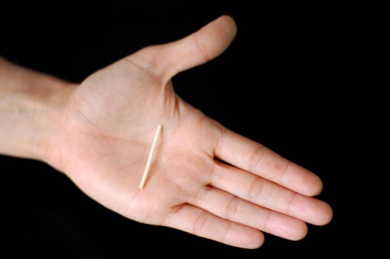 $!Así se ve el implante anticonceptivo que estaría extraviado en el corazón de la joven. Por lo general, este tipo de objetos no superan los cuatro centimetros de largo.