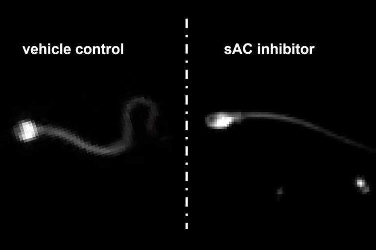 $!El inhibidor sAC elimina el movimiento de los espermatozoides, tal como se puede apreciar en la imagen.
