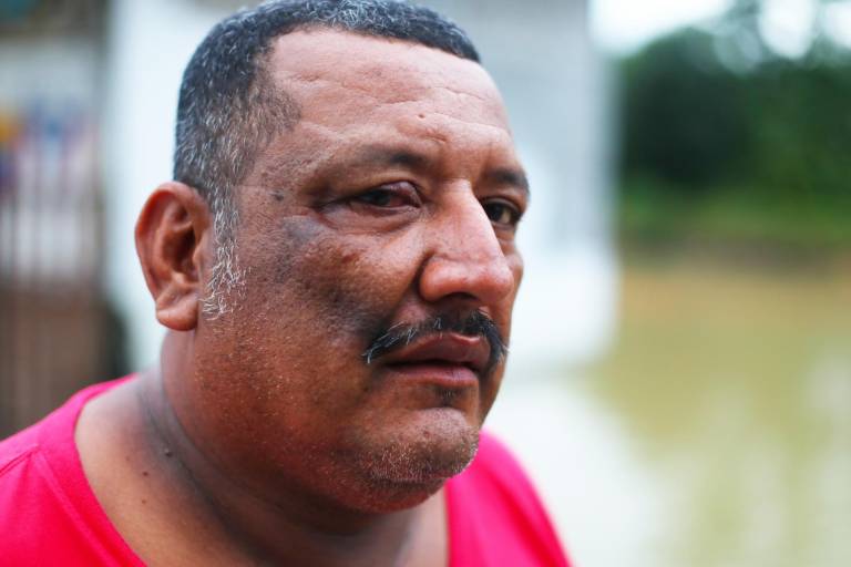 $!Hector Pincay, 54 años. Cuando finalizó su jornada laboral, no sabía del derrame de petróleo y se lavó la cara con agua contaminada. Esto le ocasionó ceguera temporal.