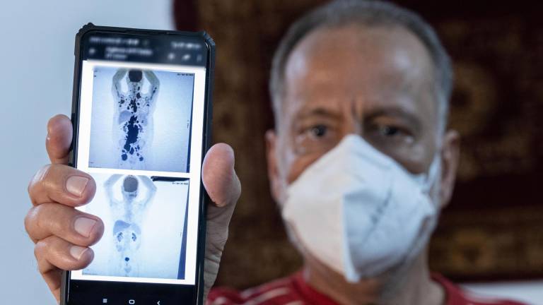 Paciente brasileño con cáncer recibió revolucionario tratamiento: se curó por completo en un mes