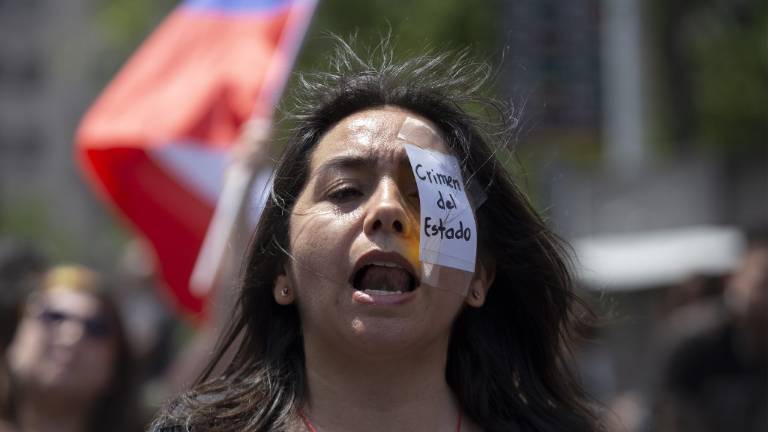 Chile, impactado por alto número de heridos en los ojos por la Policía