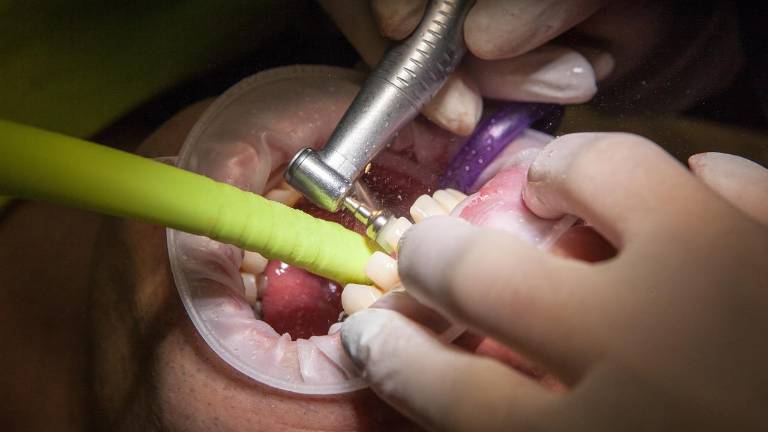 Médico ejecutó 32 procedimientos dentales en cinco horas: mujer lo demandó por desfigurarla