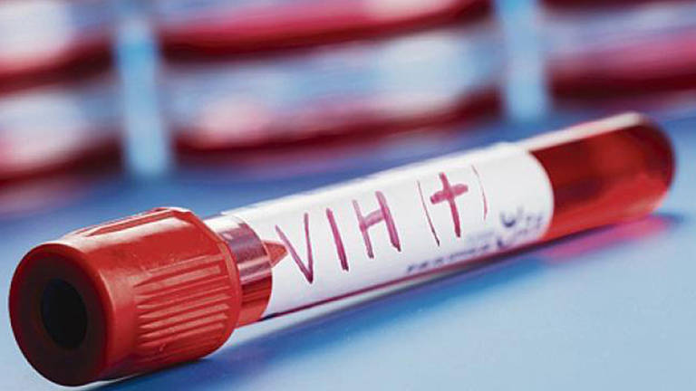 Científicos identifican nueva cepa del VIH en casi 20 años