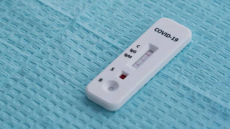 Anticuerpos contra el COVID-19 duran al menos cuatro meses, dice estudio