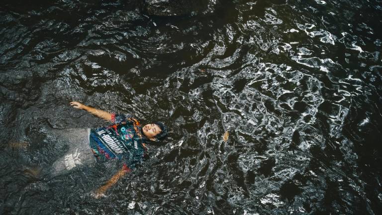 Ameba comecerebros mató a un adolescente que nadó en un estanque contaminado