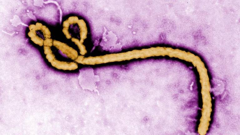 Virus de ébola permanece hasta 9 meses en semen de enfermos