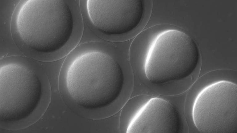 La fecundación de un óvulo en tiempo real