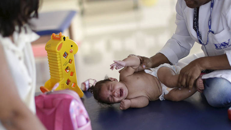 Aumentan los casos de bebés con microcefalia en Brasil