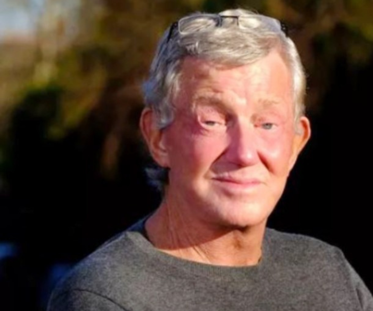 $!Pete antes de la cirugía, con las mejillas que describió como de hámster.