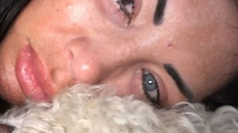 Mi visión estaba bien. Fui tan ingenua: La peligrosa cirugía para cambiar el color de ojos que se vuelve más popular cada día