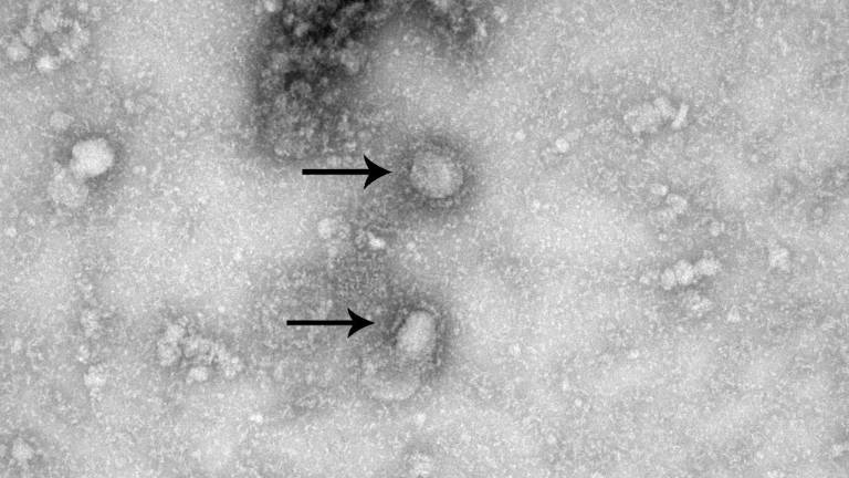 ¿Cómo se transmite, cuáles son los síntomas y la mortalidad del coronavirus?