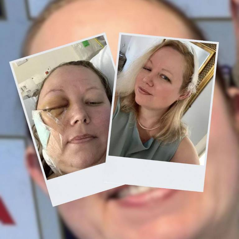 $!El antes el y después de Ciaran Morgan.