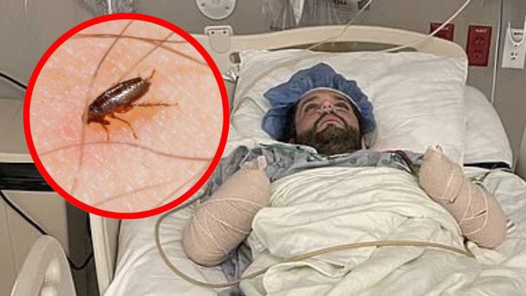 Michael Kohlhof permanece hospitalizado por una rara enfermedad causada por una pulga.