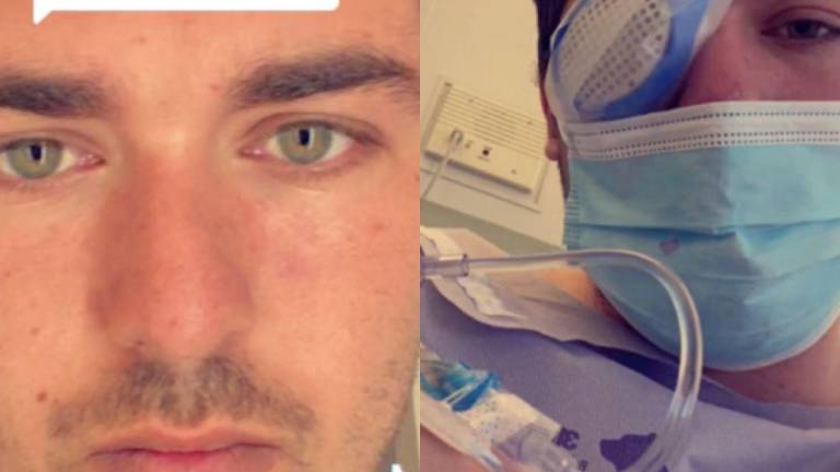Joven perdió un ojo tras haber dormido con lentes de contacto: Parásitos se comieron mi ojo