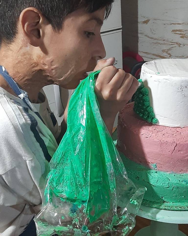 $!Niño argentino trabaja haciendo pasteles para pagar su cirugía