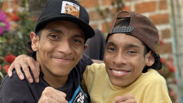 José Luis y José Armando Cevallos, los siameses del Ecuador, fallecieron en Colombia