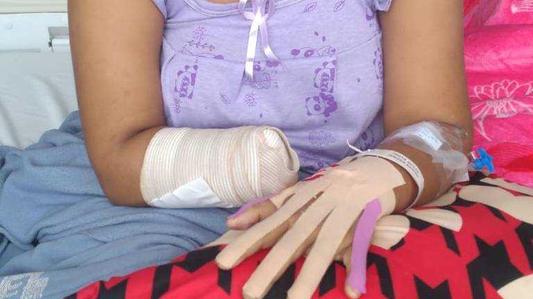 El doloroso relato de Karina después de perder una mano en un intento de femicidio en Guayas