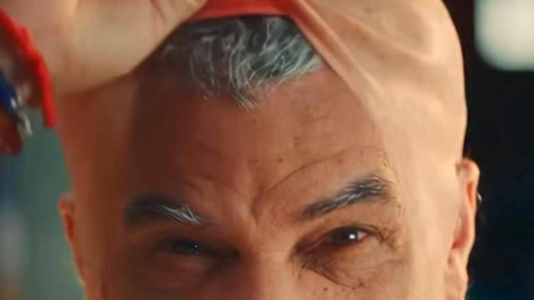 Carlos Valderrama revela que uso peluca postiza.