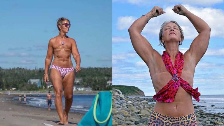 “Los senos no me definen como mujer”: influencer superó el cáncer y enseña sobre amor propio en redes sociales
