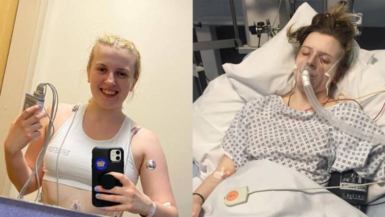 Joven fue diagnosticada con grave alergia a sus emociones, ¿cuáles fueron sus síntomas?