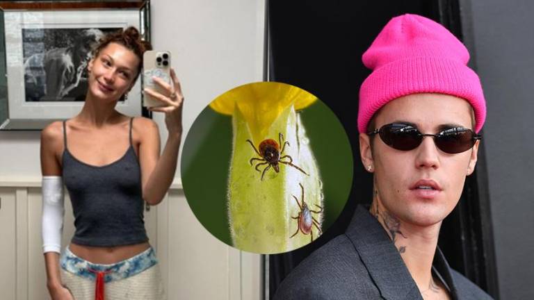 ¿Qué es el Lyme? la enfermedad causada por una garrapata que padecen celebridades como Bella Hadid y Justin Bieber