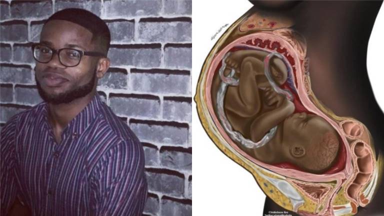 La lucha de un joven estudiante de medicina para que exista diversidad de razas en las ilustraciones médicas