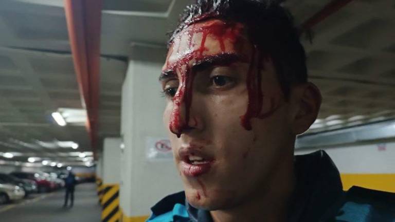 Una veintena de personas atacó a siete agentes metropolitanos de Quito