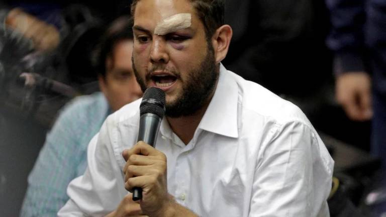 Denuncian torturas a diputado opositor preso por 'atentar' contra Maduro