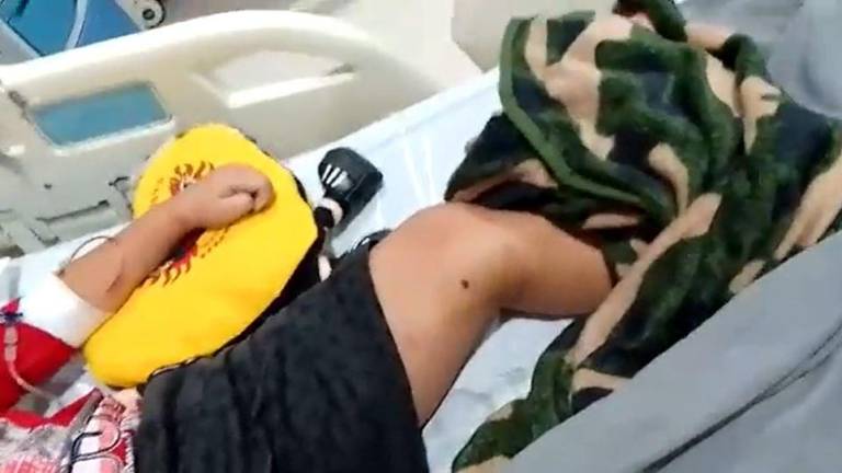 Denuncian demora en cirugía para niño con bala en la pierna; hospital se pronuncia