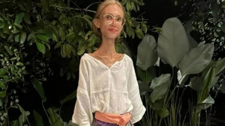 Influencer polaca muere por desnutrición tras estricta dieta basada en fruta cruda