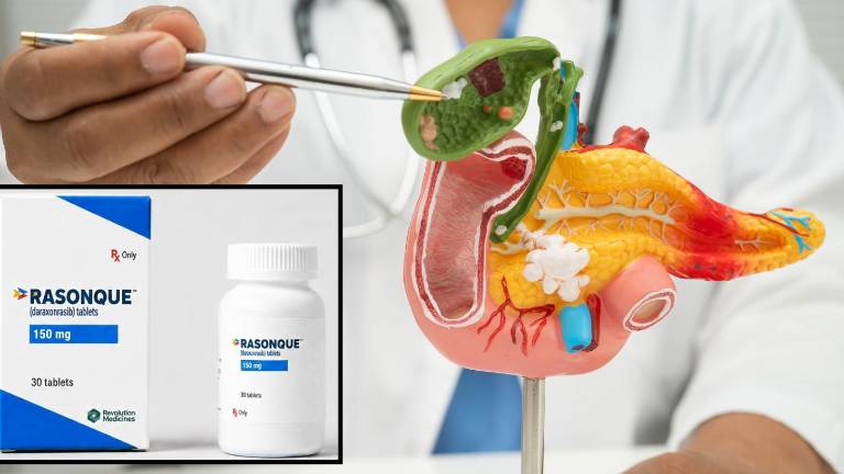 Estados Unidos aprueba nuevo tratamiento para el cáncer avanzado de páncreas
