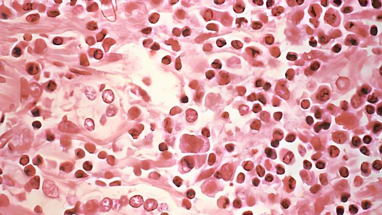 Hantavirus, bajo la mirada del microscopio.