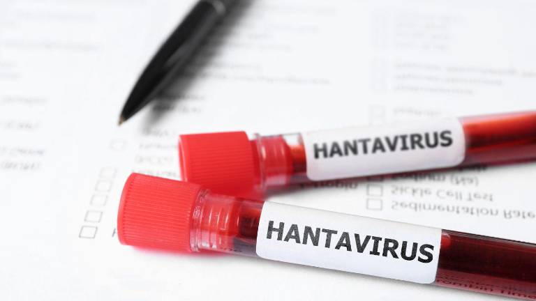 Mueren tres personas por hantavirus en Venezuela, mientras el Ministerio de Salud descarta alerta general