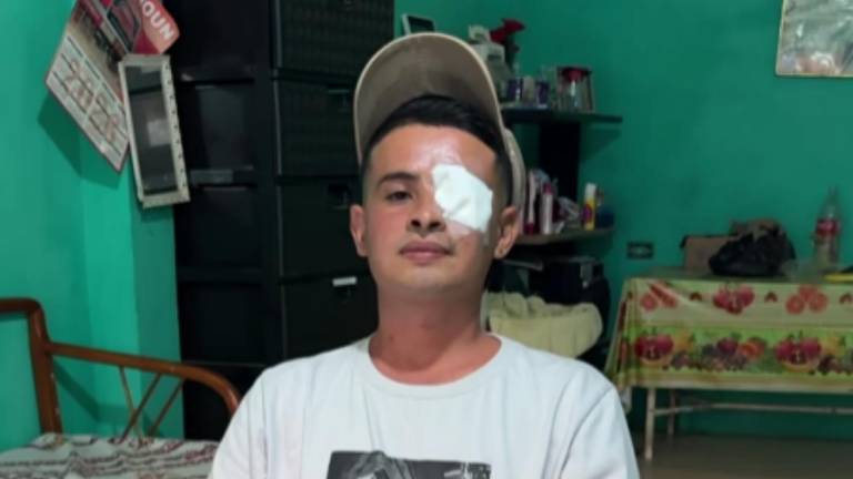 Erick Coello asegura que fue herido por explosiones en altamar.