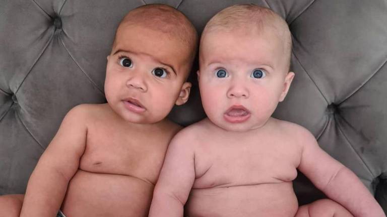Mujer da a luz a gemelos que no tienen el mismo color de piel y sorprende al mundo