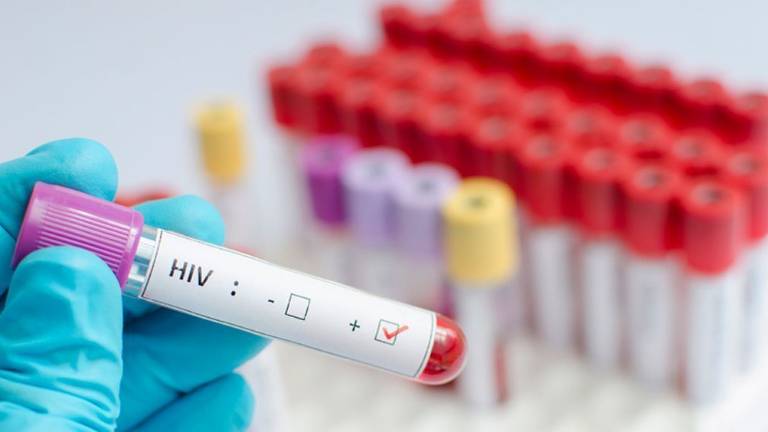 Baja mortalidad vinculada a sida en Latinoamérica, pero aumentan casos de VIH