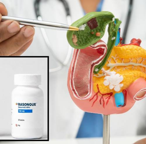 El tratamiento será desarrollado por la start-up estadounidense Revolution Medicines, bajo el nombre comercial Rasonque.