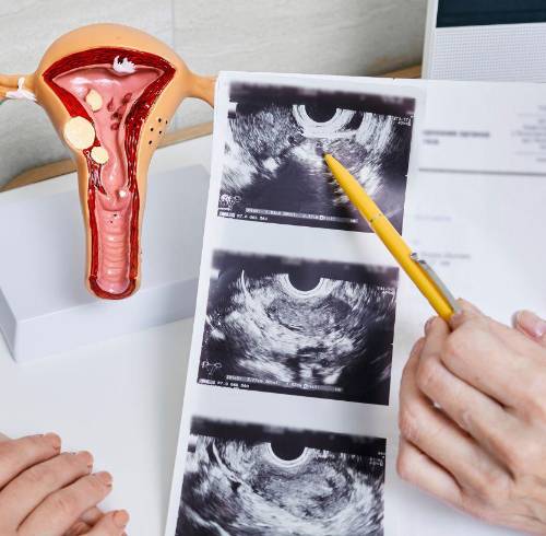 Mujer en consulta ginecológica.