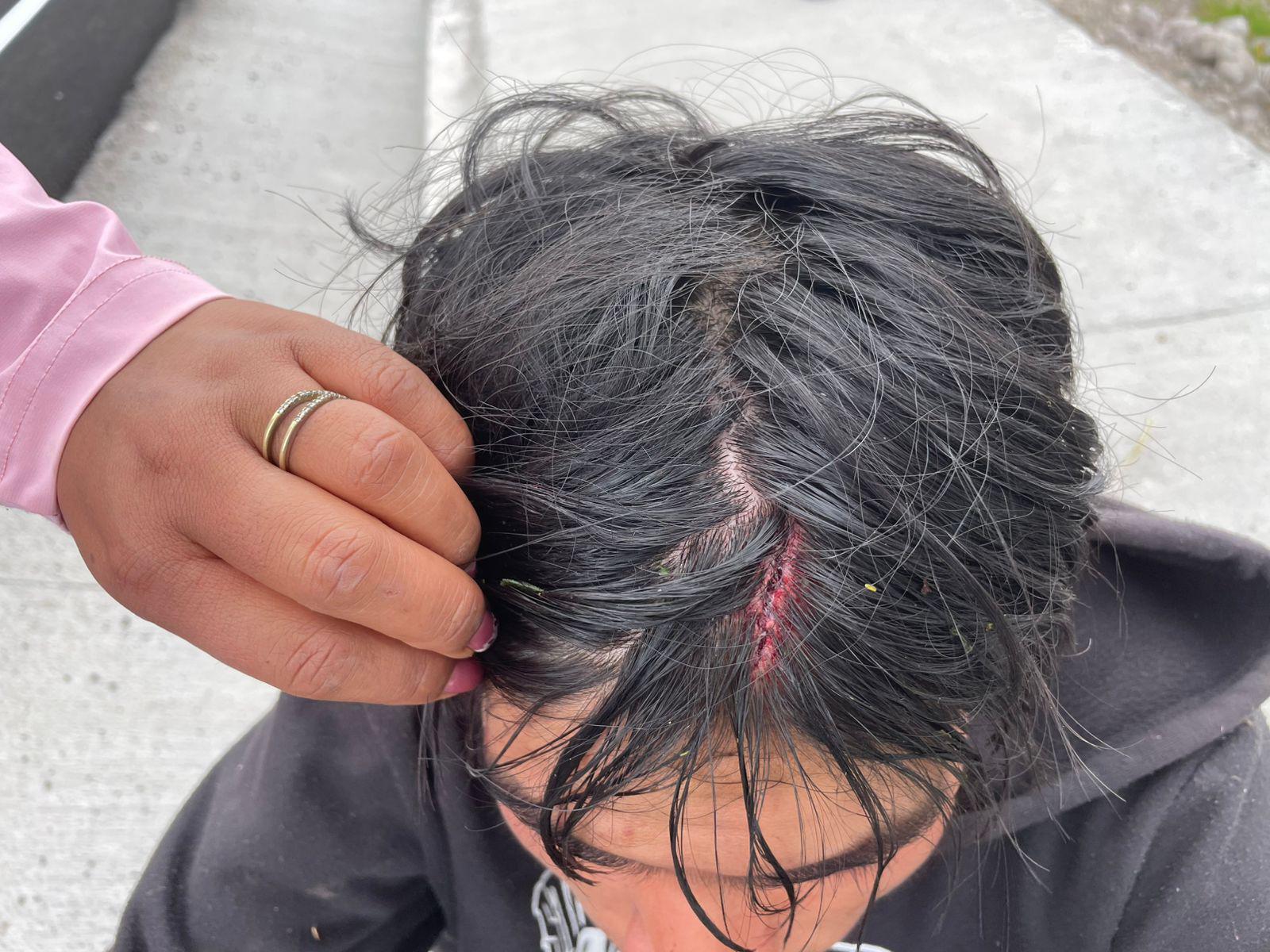 Conaie denuncia heridos 