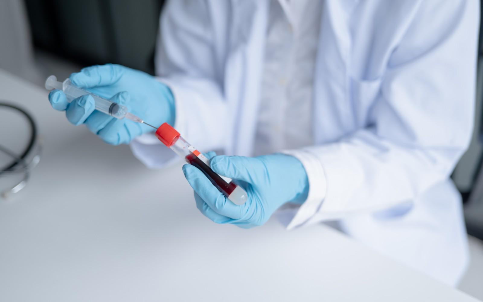 ¿Qué es el virus Shamonda? Francia reporta primer caso de la enfermedad en humanos