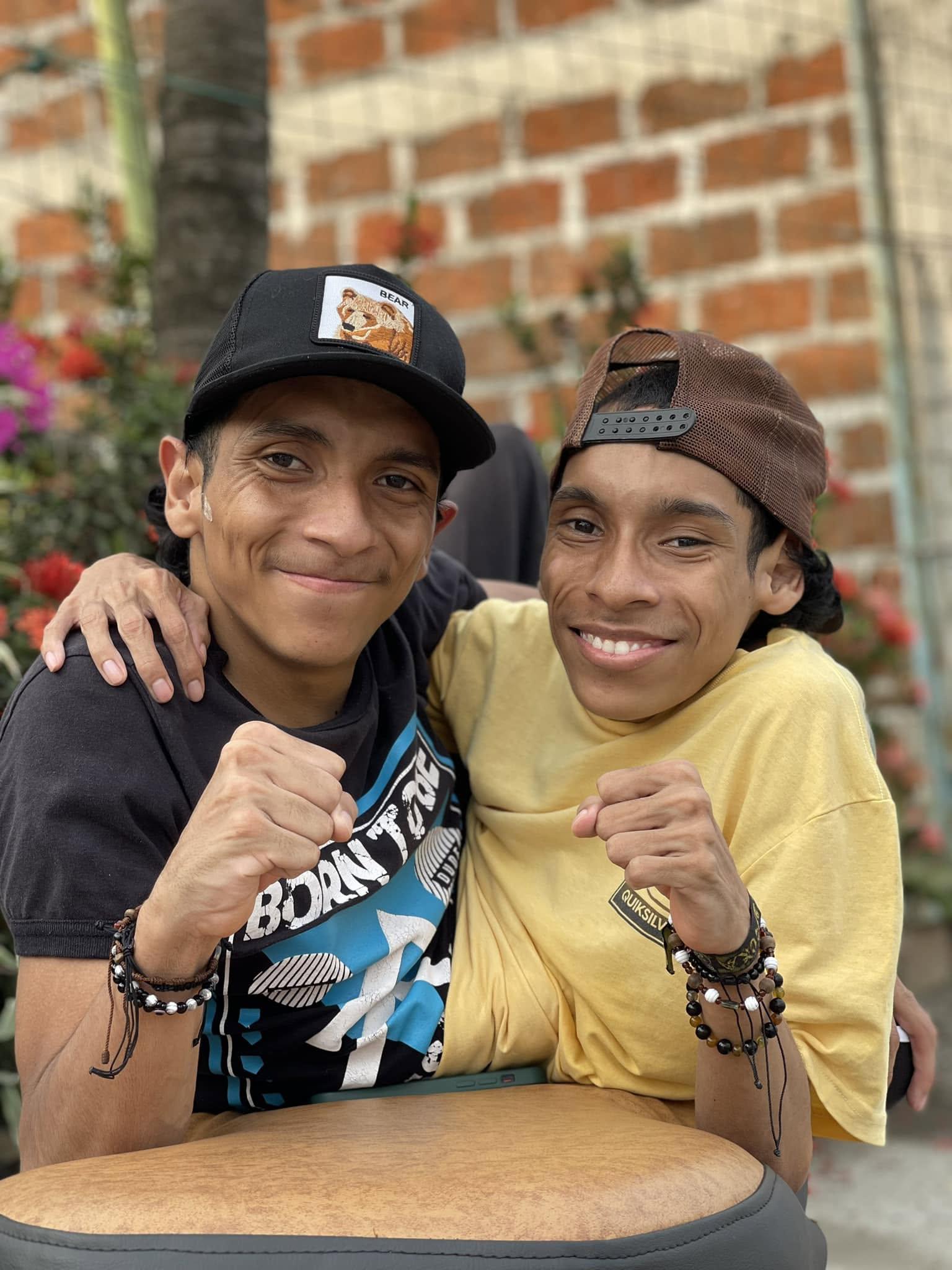 José Luis y José Armando Cevallos, los siameses del Ecuador, fallecieron en Colombia