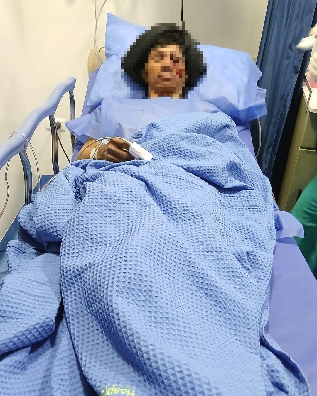 Ciudadano perdió un ojo