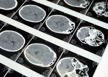 Japón estudia el cerebro y encuentra una posible vía hacia la hibernación humana que podría ayudar a llevar al ser humano más allá del Sistema Solar