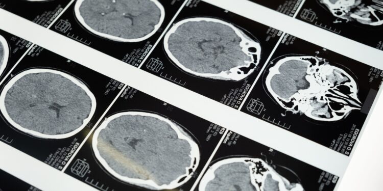 Japón estudia el cerebro y encuentra una posible vía hacia la hibernación humana que podría ayudar a llevar al ser humano más allá del Sistema Solar