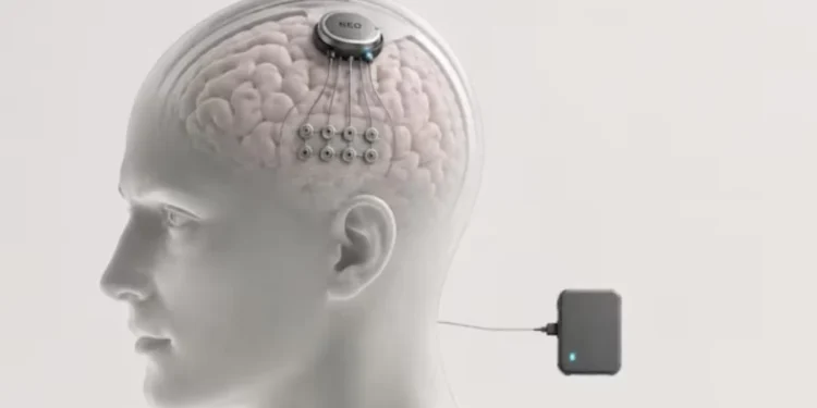 China desbanca a Elon Musk y aprueba el primer implante comercial de chip cerebral del mundo
